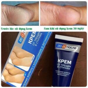 Kem chống nứt nẻ gót chân tema nga 50ml
